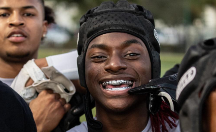 types of mouthguards 2